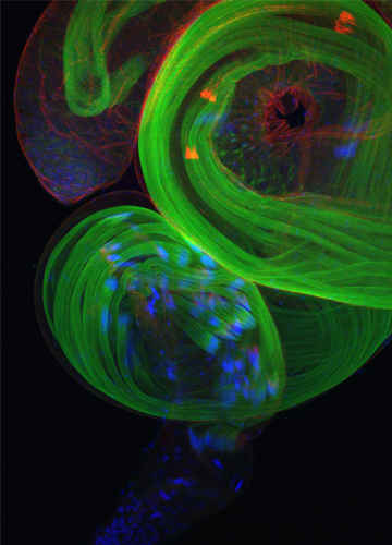 Illustration for article titled Parasites, deadly bugs and fungi are more beautiful than you could possibly imagine